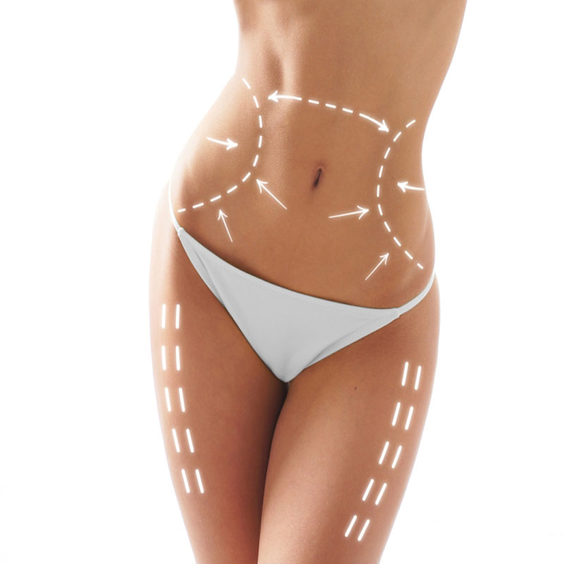 Liposuction surgery vadodara,Anand,Bharuch,Gujarat